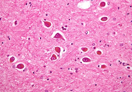 Molécula ‘multipotente’ para el tratamiento de la enfermedad de Alzheimer